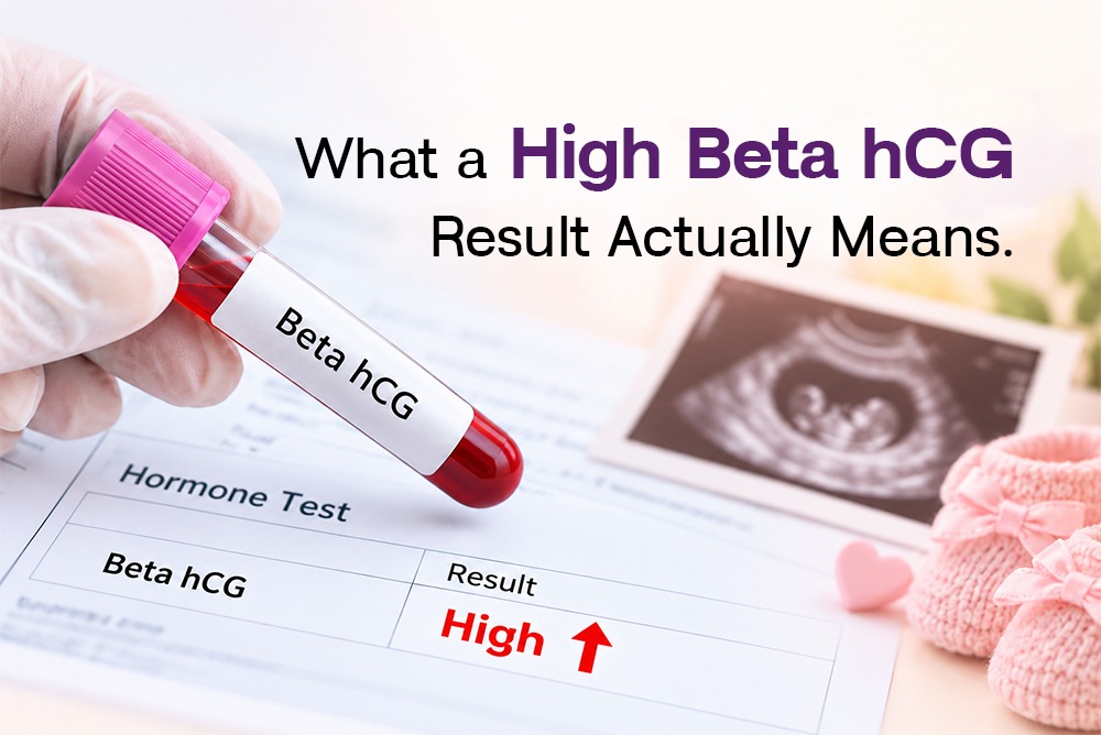 HCG Levels During Pregnancy: What a High Beta HCG Result Actually Means