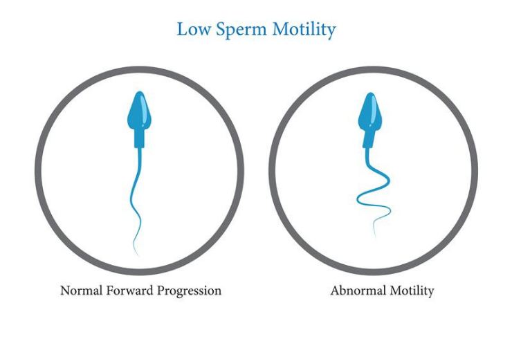 Low Sperm Motility Treatment